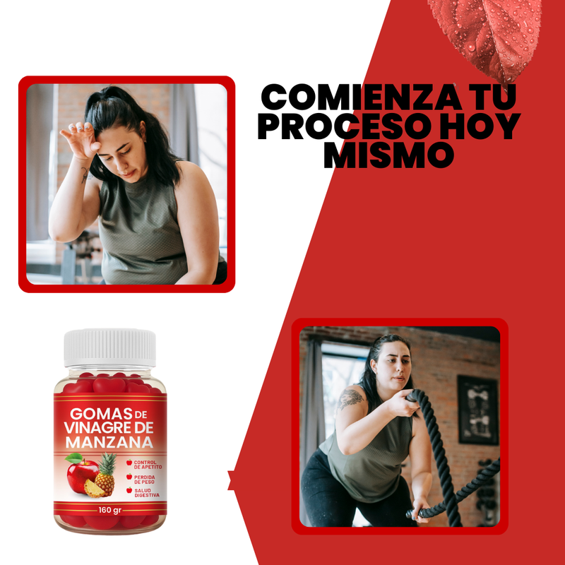 GOMAS DE VINAGRE DE MANZANA